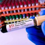 Gloved hand holding STI test tube labeled Negative.