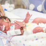 Premature newborn in NICU with monitoring tubes