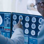 Doctors reviewing brain MRI scans on multiple monitors
